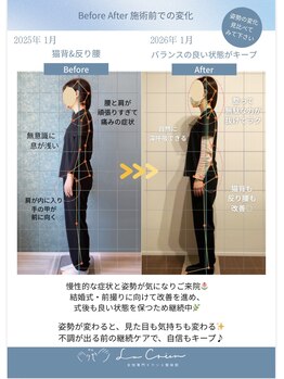 ラクリエ 姫路駅前院(La Creer)/施術ビフォーアフター/猫背/肩