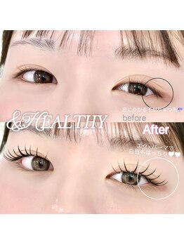 ローレルアイ 渋谷(LAUREL EYE)/アンドヘルシー/パリエク(LED)