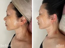 シャイネル(SHYNELL)の雰囲気（たった1回で速攻小顔！デコルテ+肩+ヘッドリンパマッサージ♪）