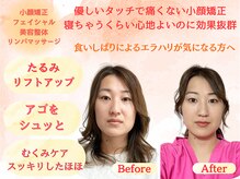 シルフィード