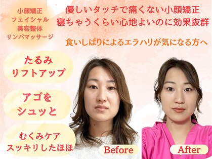 シルフィードの写真