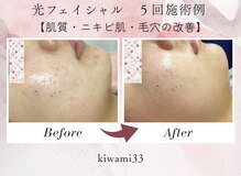 キワミ サーティスリー(kiwami33)