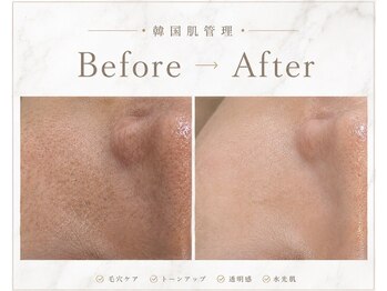 アンフィア(Anfia)の写真/元美容看護師監修、結果重視の肌管理サロン★白を基調としたラグジュアリー空間でお肌悩みへアプローチ◎
