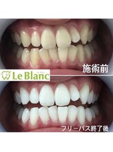 ルブラン 奈良店(Le Blanc)/休まず営業しています