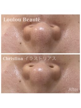 ルルボーテ(Loulou Beaute)/イラストリアス