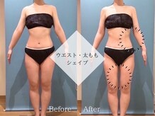 ピュアエステブリアント 銀座店/お客様の結果［銀座/痩身］