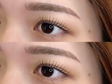 アイプラスサンテ (eye+sante)