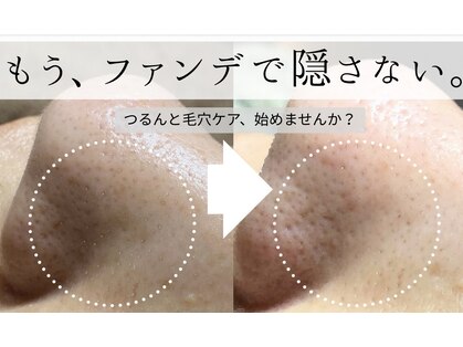 ニコラフ(Nico laugh)の写真