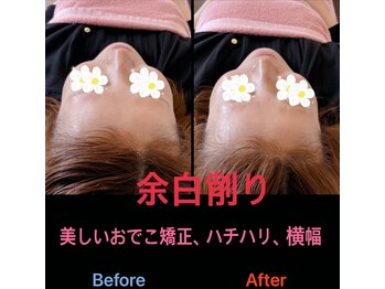 美容矯正サロン レレポノ(LELEPONO)/