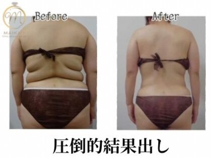 マイカイ(MAIKA'I)の写真