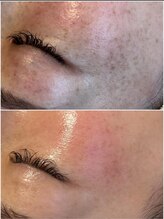 ビエン(bien)/モヤモヤシミにも納得の仕上がり