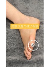 いまはやし鍼灸整体院 香椎和白店/逆子のお灸/鍼/マタニティ