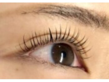 スタジオ スキンプロ(STUDIO SKINPRO)/過去のお客様施術です♪