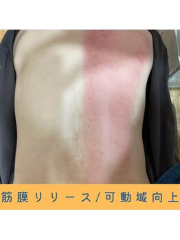 いつつのき/スライドカッピング