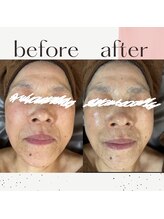 ミルル(milulu)/年齢に負けない肌へ