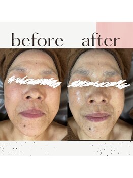 ミルル(milulu)/年齢に負けない肌へ