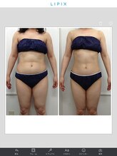 健康痩身研究所 名和店/ビフォーアフター