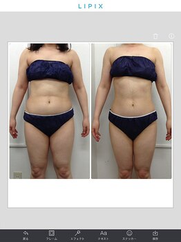 健康痩身研究所 名和店/ビフォーアフター