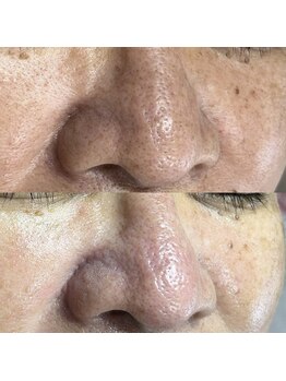 シャイニー(SHINY)/60代女性