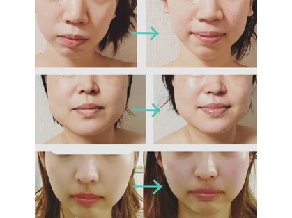 サロンドアクオン(salon de aqon)の写真