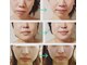サロンドアクオン(salon de aqon)の写真