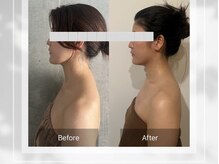 メグルサロン 自由が丘(MeguruSalon)の雰囲気（【サイズや歪み】は筋膜から整え、リンパを流し黄金比へ★）