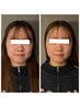 大人気★【小顔革命！】オーダーメイド頭蓋骨小顔矯正　