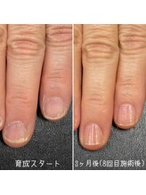 ネイルズ アヴァンティ(Nails Avanti)/自爪育成ネイルケア