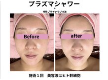 マリア(MALIA)/＃毛穴#ハリ#ツヤ#南森町#