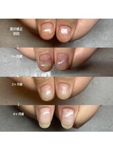 プティット シュシュ(Petit Chouchou)/育爪コース