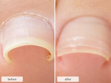 ディグニティ(Dignity)