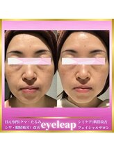 アイリープ(eyeleap)/☆ララピール