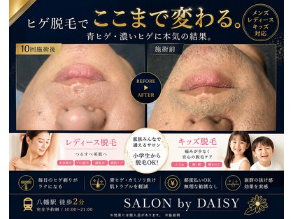 サロン バイ デイジー(SALON by DAISY)の写真