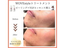 サロンドゥレーヴシエル(Salon de reve Ciel...)/【WOVEstyle】トリートメント 