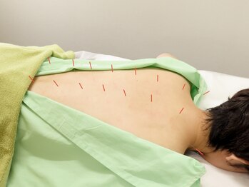 養源堂 西小山院の写真/【自律神経の乱れなどお悩みの方必見★】慢性疲労/頭痛/不眠/動悸・不安/内臓の不調など難しい症状にお勧め