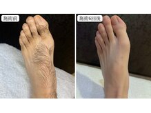 トパーズ 掛川店(Topaz)の雰囲気（気になる足.手の甲などパーツ脱毛も各種ご用意 VIO脱毛も施術◎）