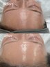 【極上たまご肌】韓国式3D毛穴洗浄☆ 回数券ご購入の方　90分