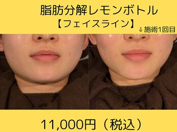 美々庵/レモンボトル/痩身/ブライダル