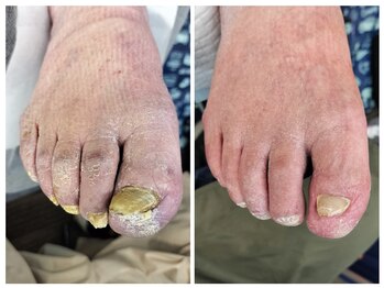 フレッシュフット(FreshFoot)/足のトラブルお任せください