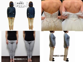 練馬アカデミア美容整体院の写真/姿勢・骨盤・骨格のズレが不調の原因⇒ 世代別のお悩みに特化した美容整体/矯正でより美しさと健康を引出す