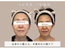 マリーズウィル(MARY's WILL)の雰囲気（全身から整えるから、フェイスラインまで驚くほど美しく。）