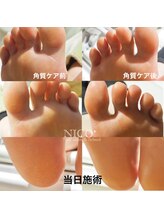 ニコプラス(NICO+)/