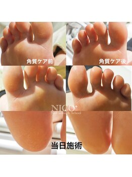 ニコプラス(NICO+)/