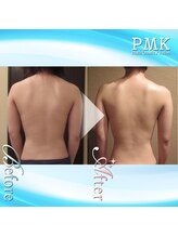 PMK 新宿店/バストUPケア20回（背中）施術