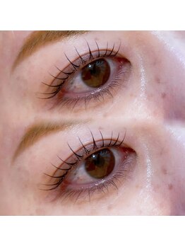 トップブロウ 天王寺(TOP BROW)/ムーンロッド