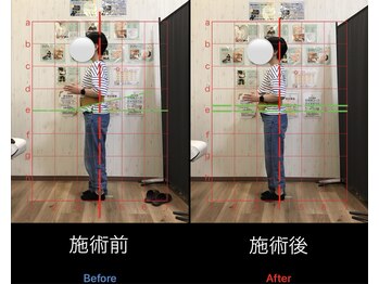 そね健康整骨院/産後の骨盤矯正！反り腰改善！！
