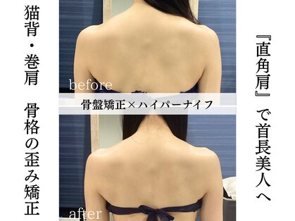 ミルクディッパー(Milk Dipper)の写真