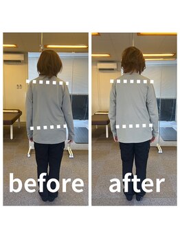 熊本カワル整体 JR上熊本駅院/骨盤の歪み