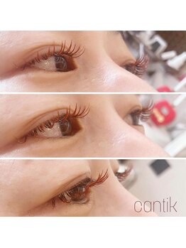 チャンティック (CANTIK)/