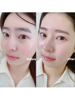 アイルブロウ 西宮北口(I'LL)/setで垢抜けられるクーポン☆